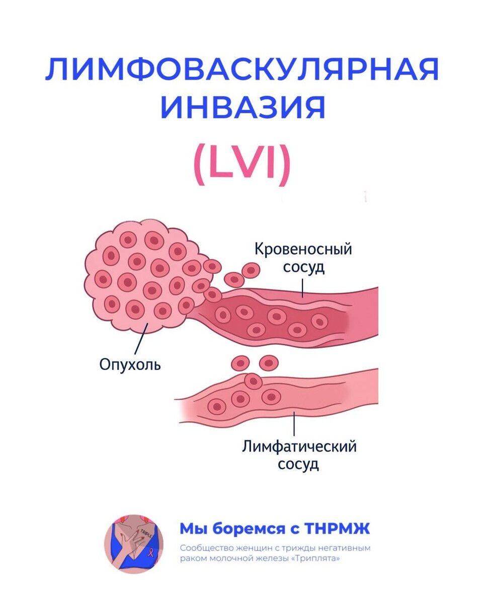 Лимфоваскулярная инвазия