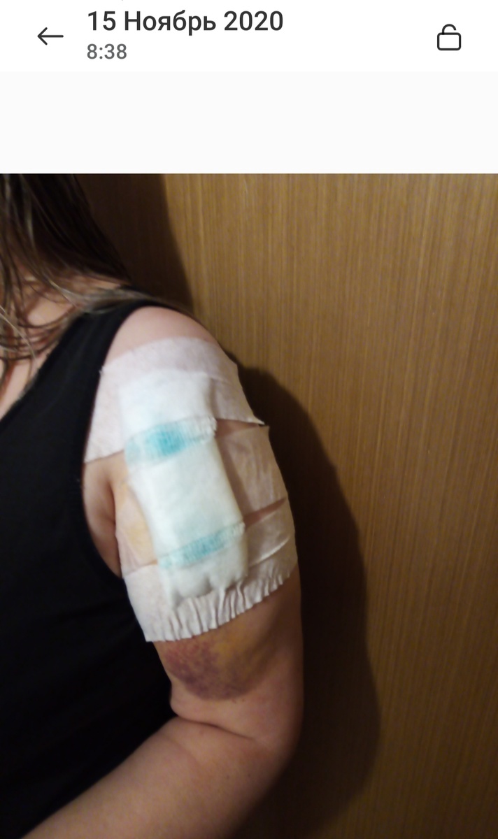 Итак, за  3 дня управились! Поступила, на следующий день - операция. Потом дежурный врач сделал мне перевязку и оставил ещё на одну ночь, а утром меня выписали домой... 