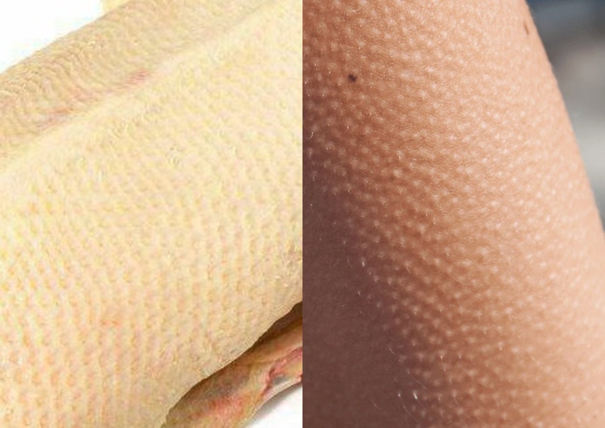 Действительно же "гусиная" кожа