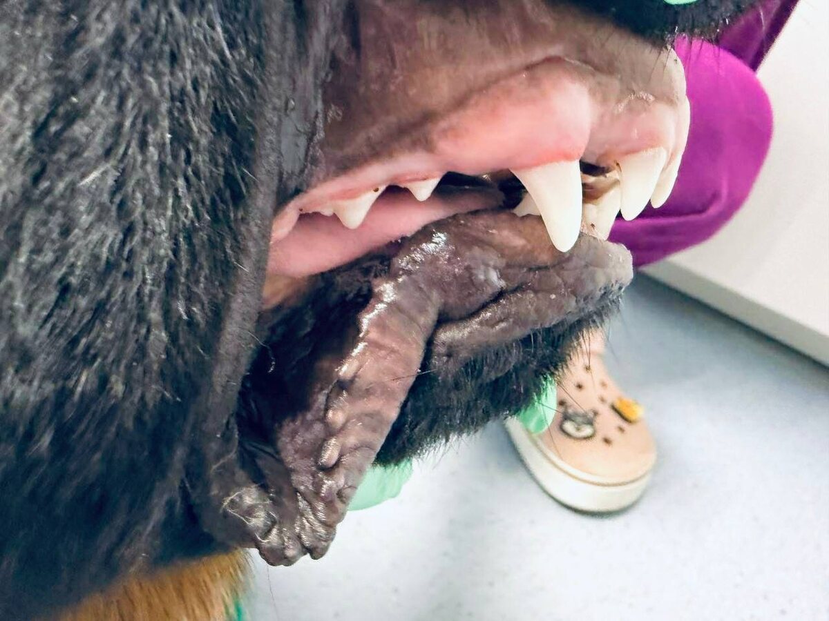 Травмвтический прикус