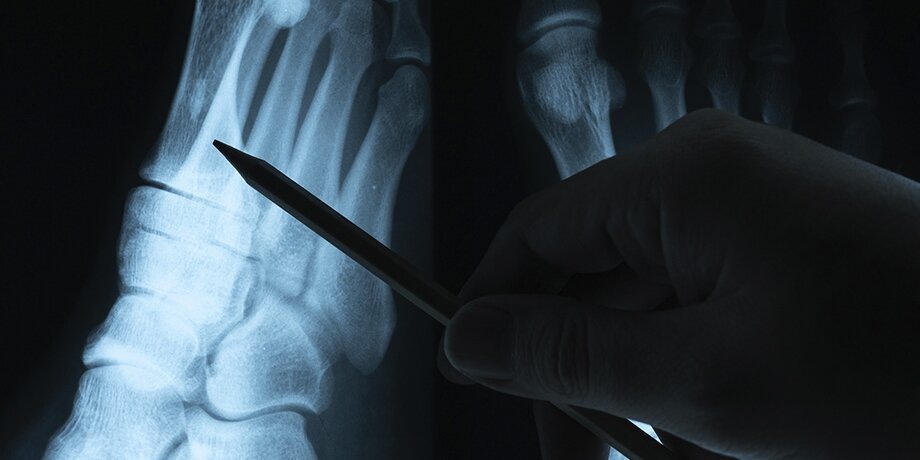    Фото: 123RF/alicephoto