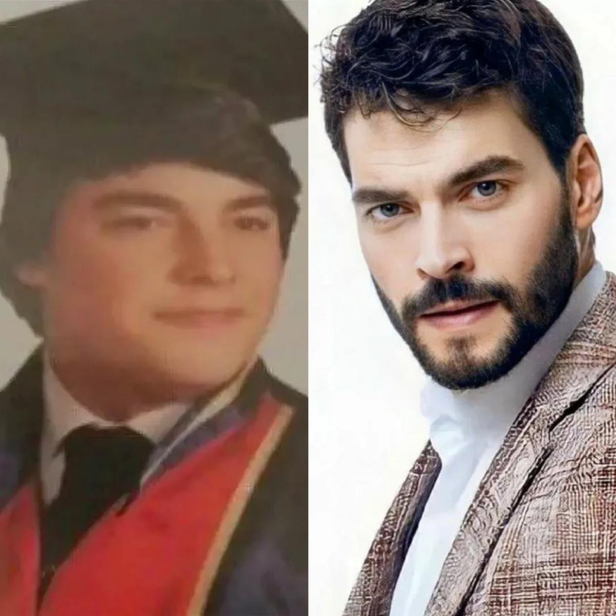 Акын Акынозю в детстве и сейчас 