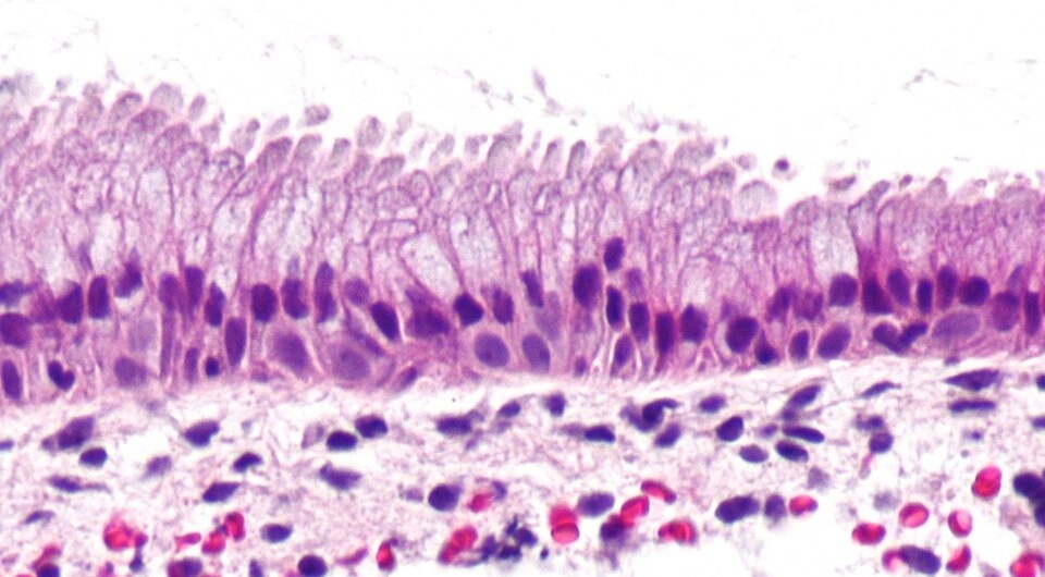   Nephron / Wikimedia Commons / CC-BY-SA-3.0