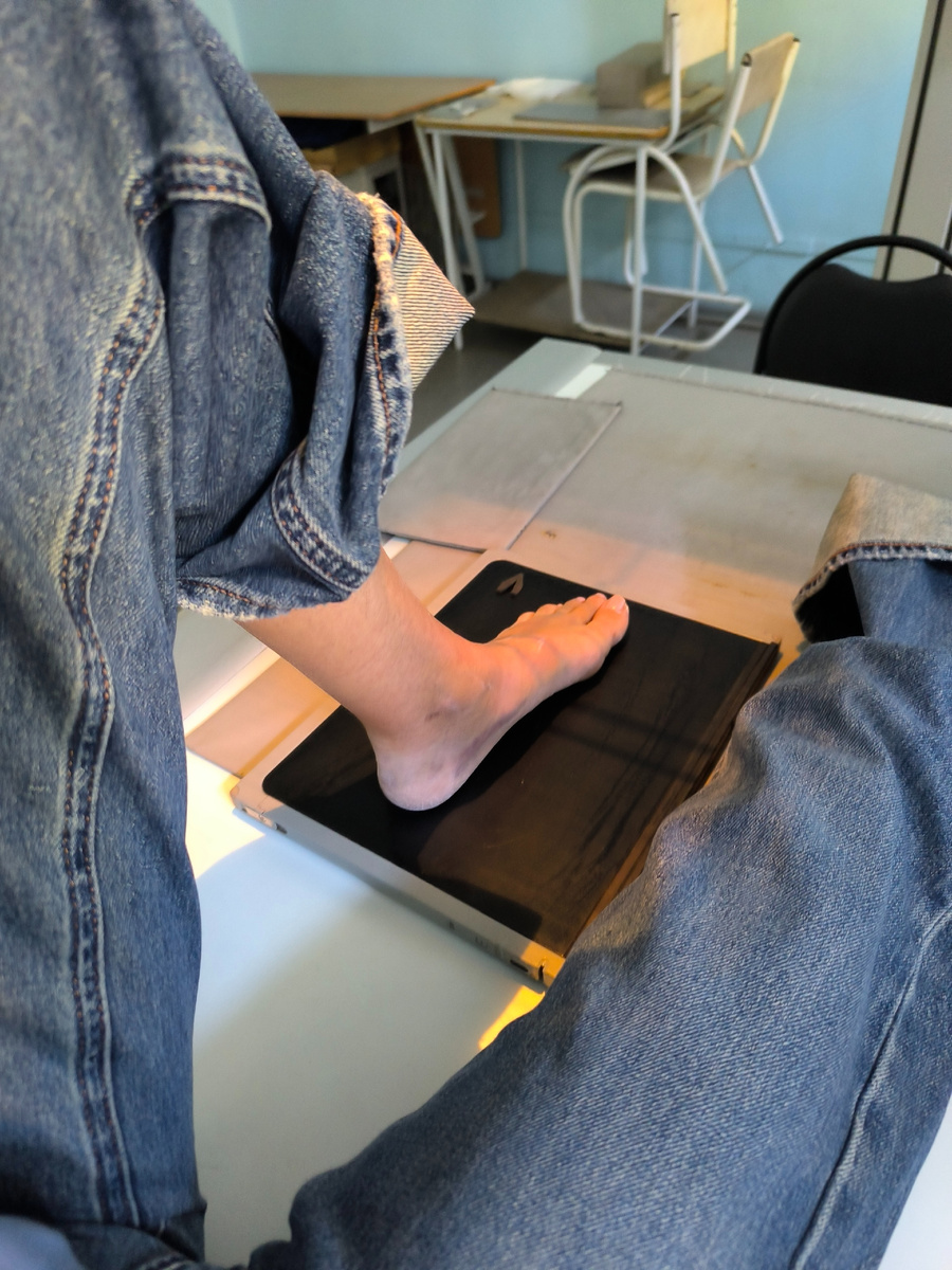 На рентгене. В пятый раз за три недели. Надеюсь, я не начну светиться по ночам (© Анна, «Маяк энерджайзера»)