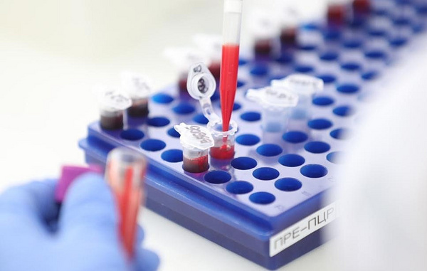 Петр Ковалев/ ТАСС