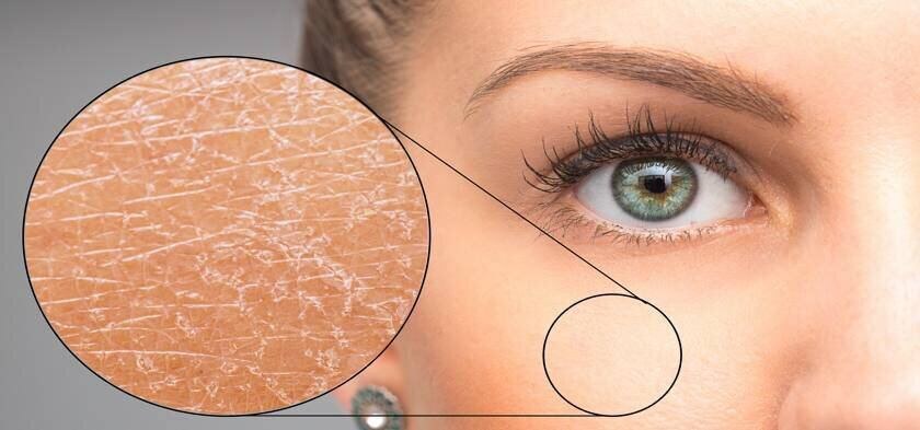 Сухая кожа может и врожденной, и приобретенной особенностью. Если ваш домашний уход неэффективен - обратитесь к врачу-косметологу, он поможет составить прокол ухода, который эффективен именно в вашем случае