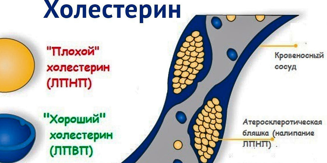 Холестерин — ваш враг или ваш спаситель? Почему врачи ошибаются, фармацевтика обманывает, а вы теряете здоровье, боясь этой одной молекулы