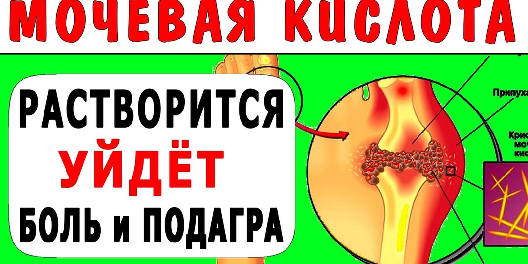 Мочевая кислота и суставы: что скрывает анализ крови