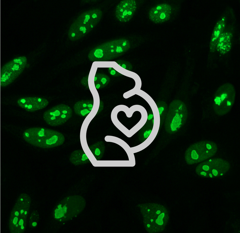 H Yoshihara, S Goto, Tamao Kitaori, M Sugiura-Ogasawara, Association between antinuclear antibodies and pregnancy prognosis in recurrent pregnancy loss patients, Human Reproduction, Volume 40, Issue 2, February 2025, Pages 236–243, https://doi.org/10.1093/humrep/deae280