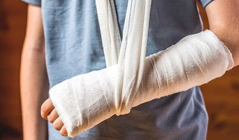 Как ухаживать за гипсовой повязкой?