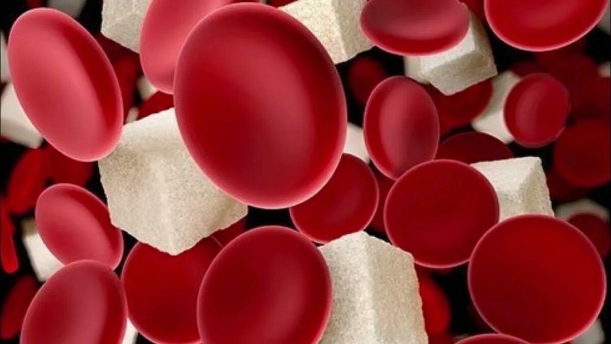 Повышенный сахар