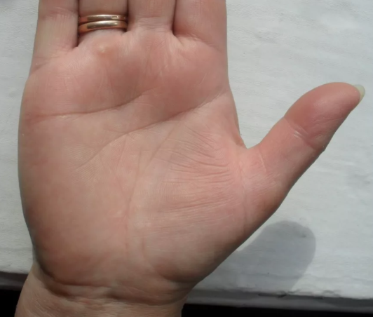 Короткая Линия Сердца