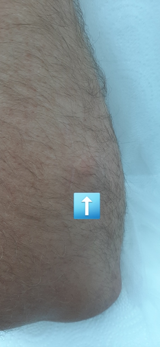 Перед операцией. Более крупный план.