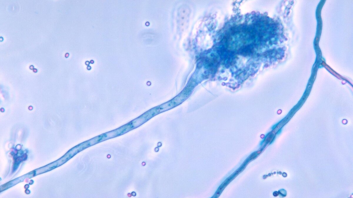 Фото: wikipedia.org/Dr. Libero Ajello; Общественное достояние