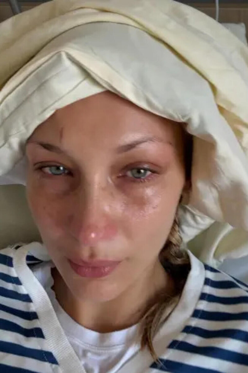    Белла Хадид встревожила своим видом