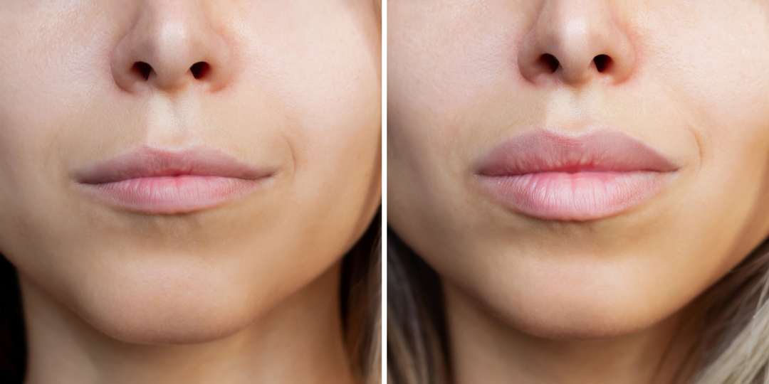 Сочные губы и легкая улыбка — 7 упражнений от старения рта