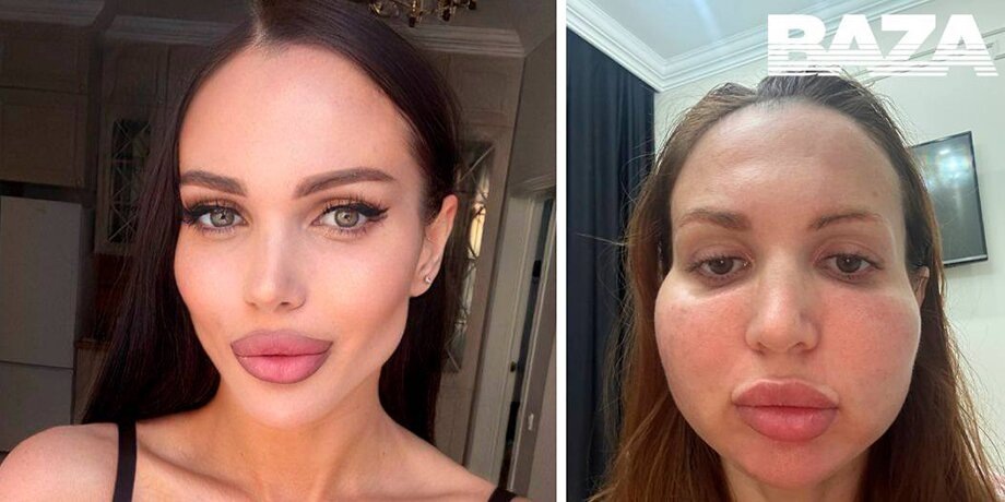    Фото: телеграм-канал Baza