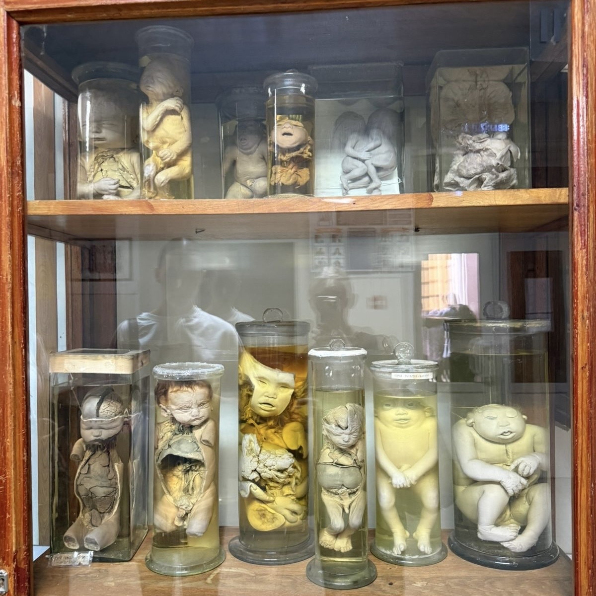 Дочь шлет фотки с анатомички