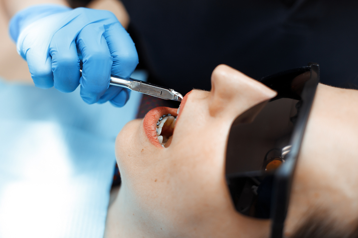 Фотография взята с сайта стоматологии Дмитрович Фэмили https://www.dmitrovich.ru/