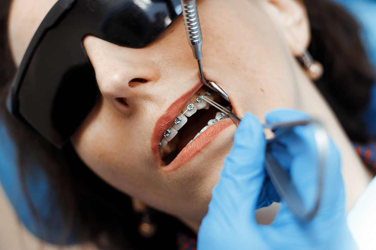 Фотография взята с сайта стоматологии Дмитрович Фэмили https://www.dmitrovich.ru/