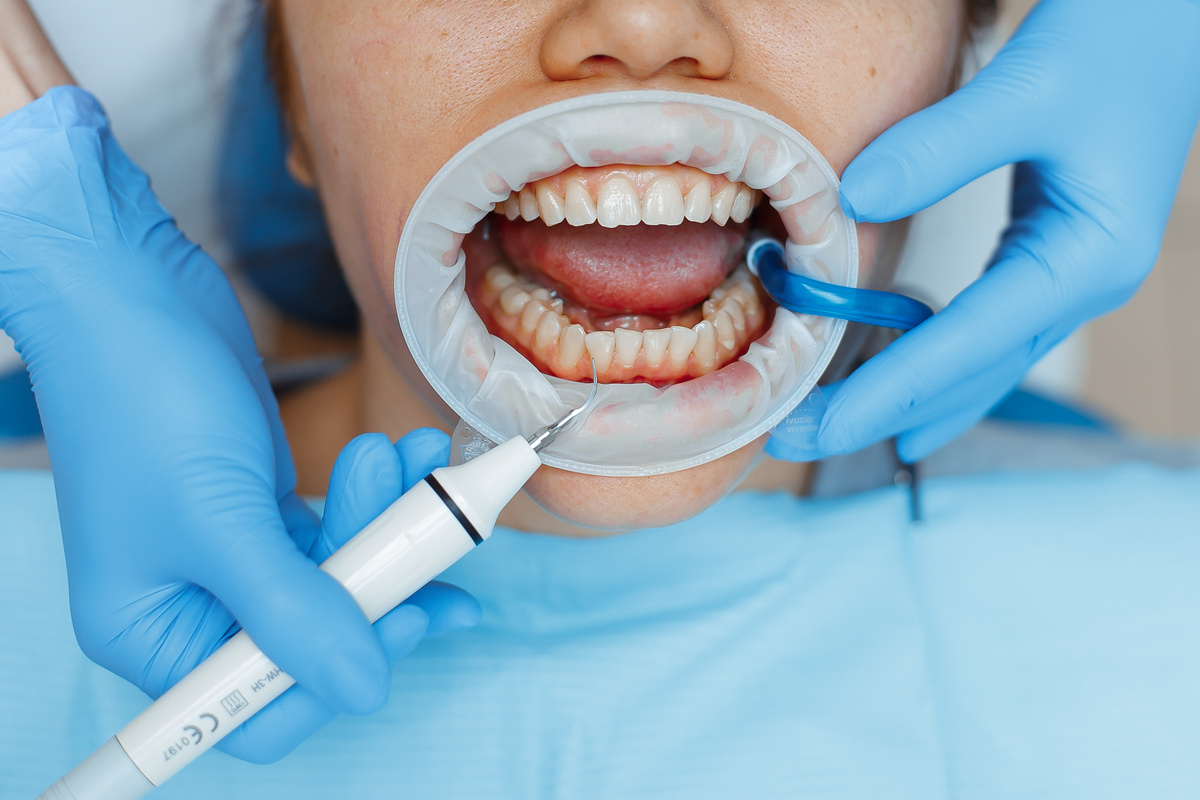 Фотография взята с сайта стоматологии Дмитрович Фэмили https://www.dmitrovich.ru/