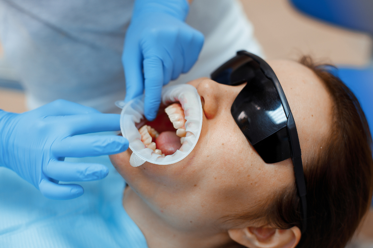 Фотография взята с сайта стоматологии Дмитрович Фэмили https://www.dmitrovich.ru/