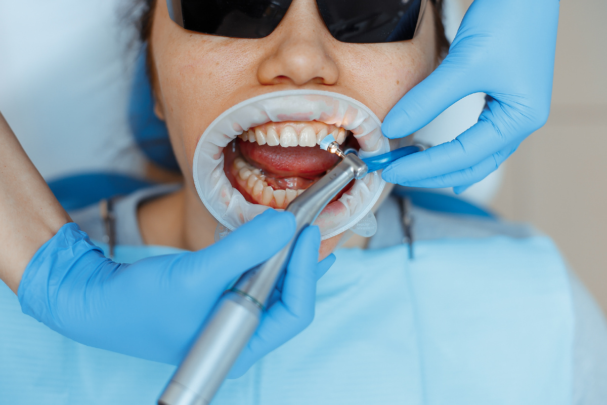 Фотография взята с сайта стоматологии Дмитрович Фэмили https://www.dmitrovich.ru/