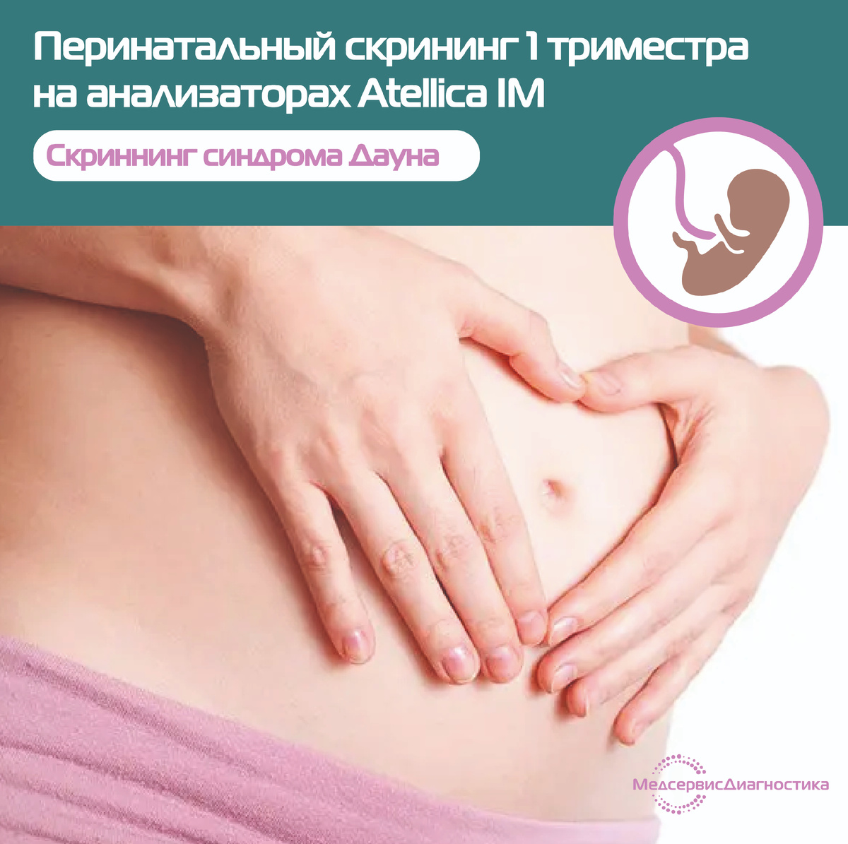 Скриннинг синдрома Дауна для беременных