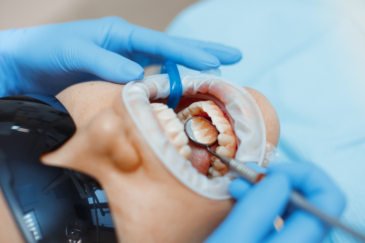 Фотография взята с сайта стоматологии Дмитрович Фэмили https://www.dmitrovich.ru/