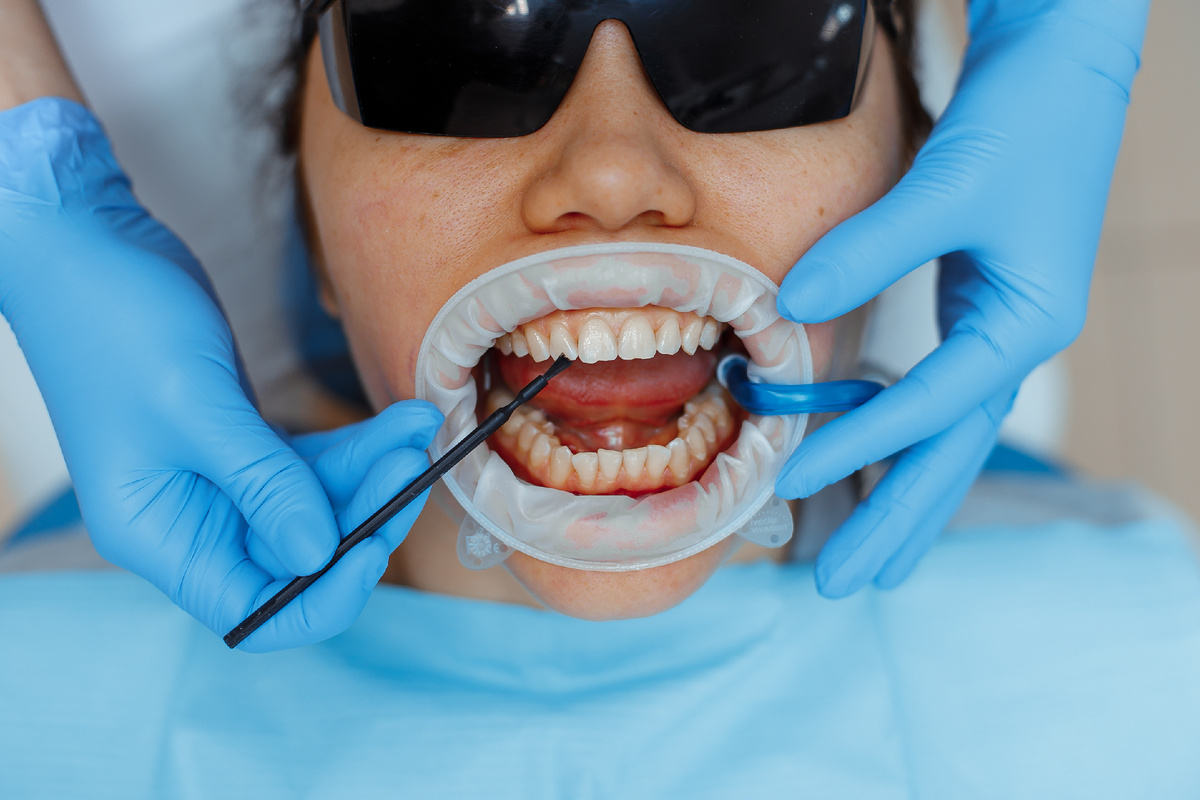 Фотография взята с сайта стоматологии Дмитрович Фэмили https://www.dmitrovich.ru/