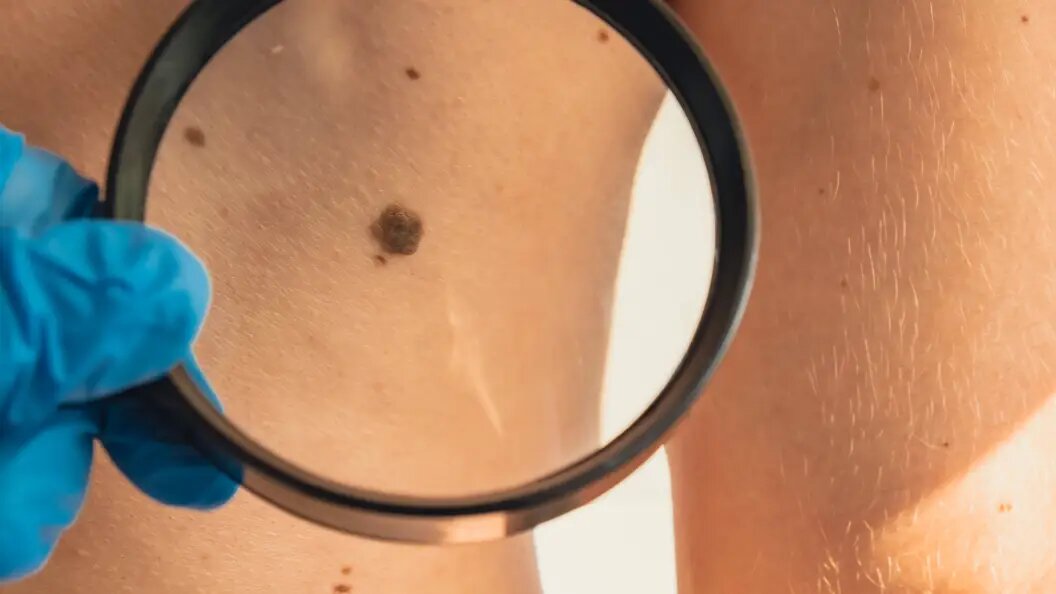    Фото: IMAGO/Zoonar.com/Anastasiia Yani/Globallookpress