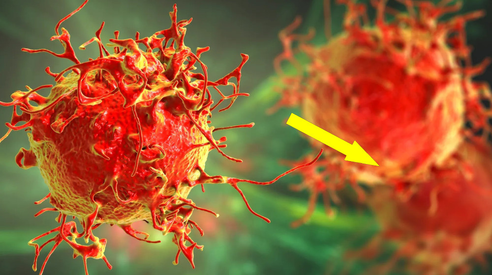    Как вирусолог Беата Халасси обошла медицину и выиграла войну с раком