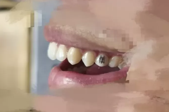 Как оцениваете такую улыбку? Я так злодея из фильмов о Джеймсе Бонде представляю...