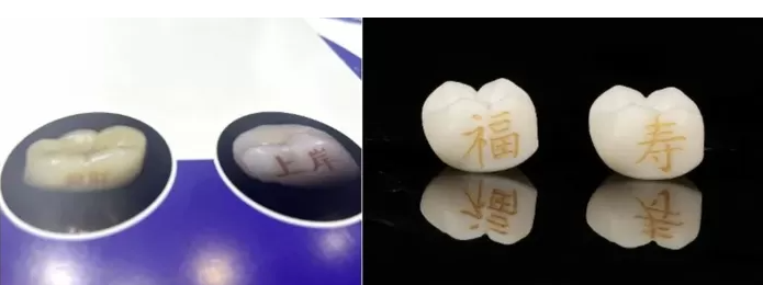 Примеры из буклетов китайских стоматологий