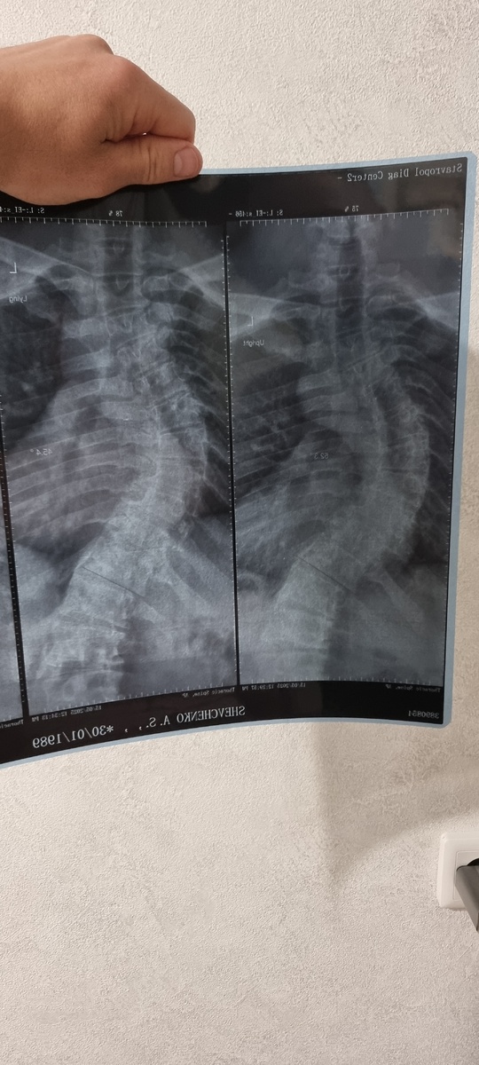 Снимок позвоночника