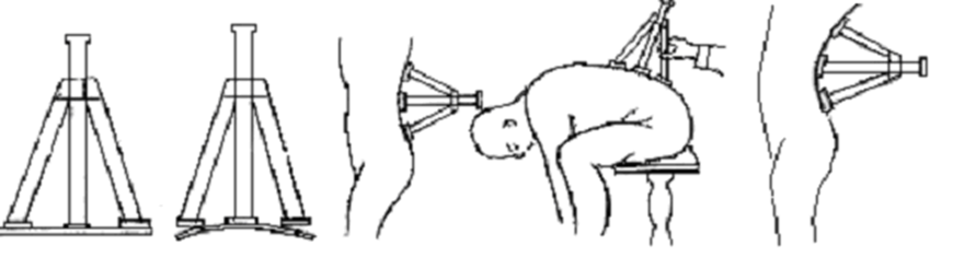           а                         б                      в                                        г                                  д

Рисунок 4. Измерение глубины прогиба поясничного отдела. (Заимствовано у Г.С. Юмашева и М. Е. Фурман):
а – нулевое положение прибора; б – сдвиг стержня (линейки), который потребуется при измерении выраженности кифоза; в – измерение выраженности лордоза в положении покоя; г – измерение пределов максимального поясничного кифозирования; д – измерение пределов максимального лордозирования.
