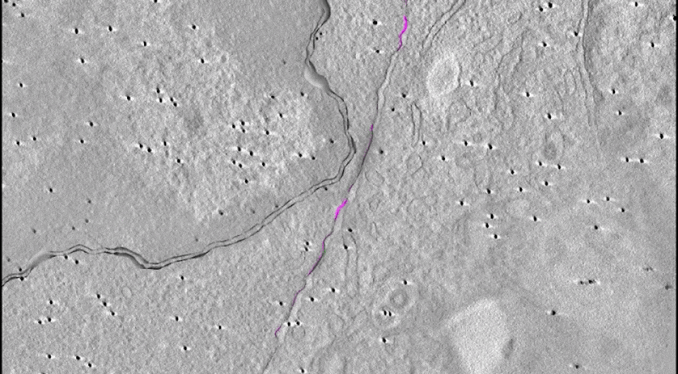   Yukako Asano et al. / Science Immunology 2025