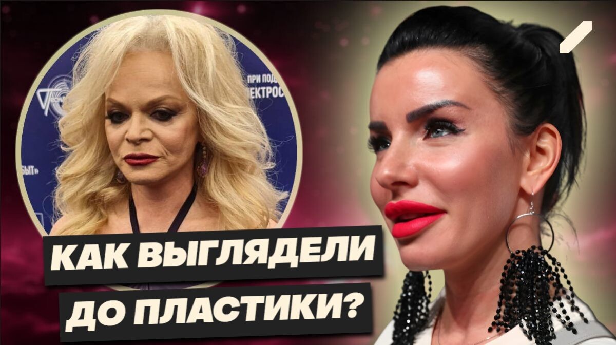 Погоня за вечной молодостью: топ-5 российских звёзд, изменившие себя до неузнаваемости