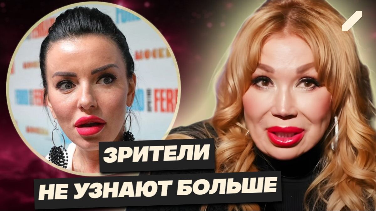 Теперь их не узнать: как пластика изменила лица звёзд России — Долина, Волкова и другие