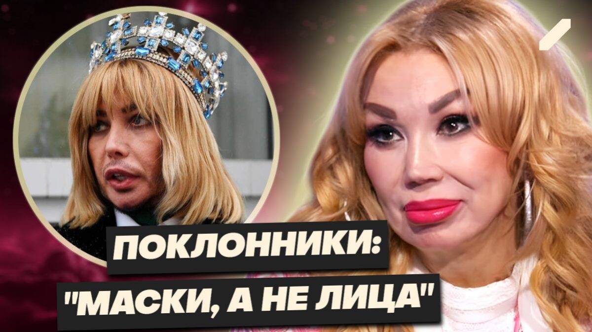 От Долиной до Распутиной: звёзды России, которые слишком увлеклись пластикой