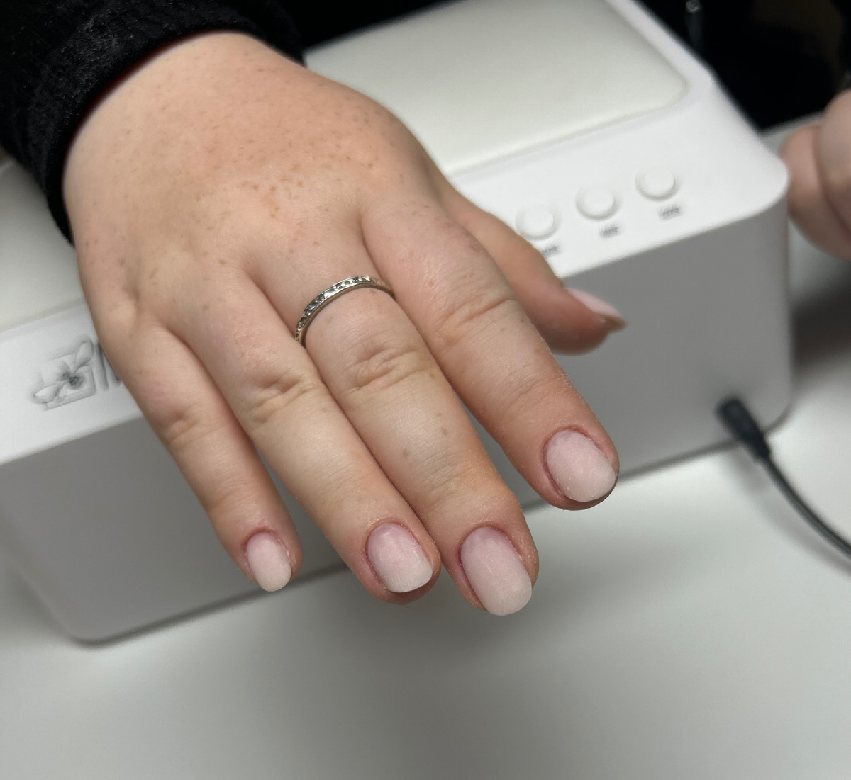 Вот так выглядели ногти после снятия и предварительного опила формы