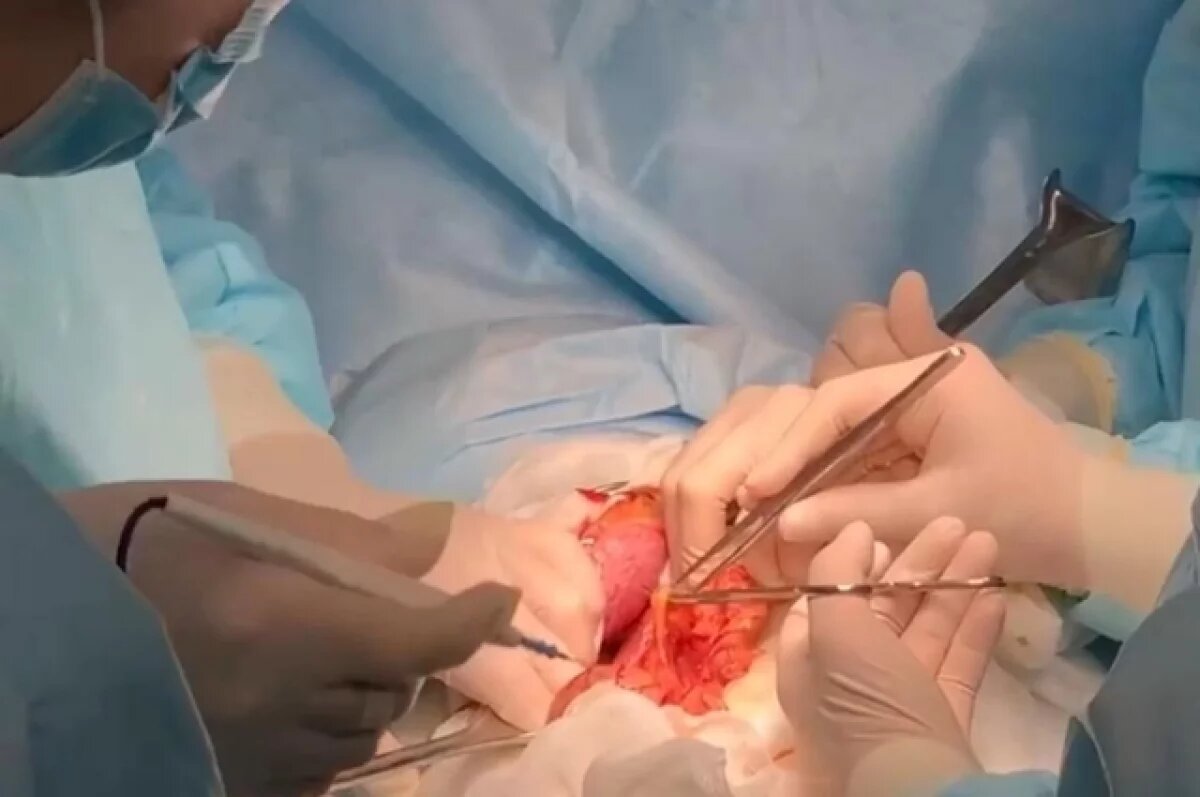    Огромную мутировавшую печень удалили врачи Владивостока у пациентки