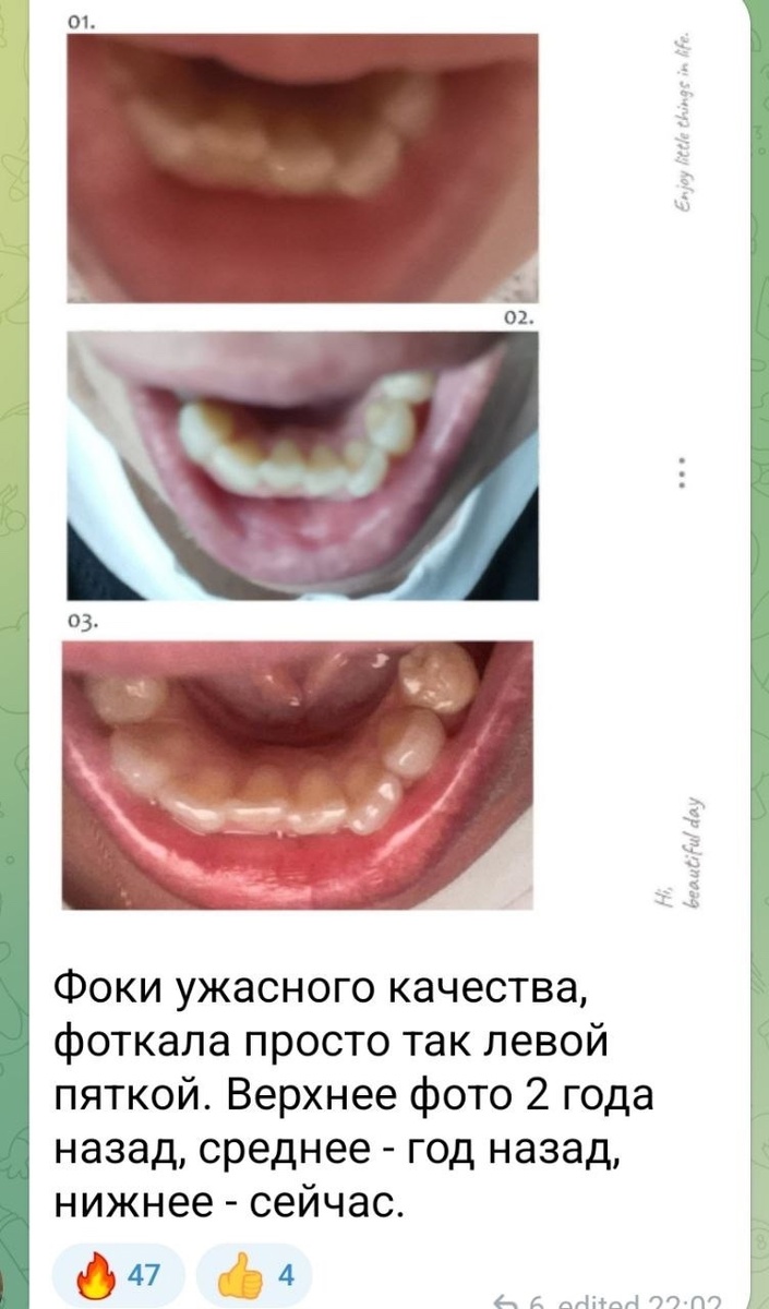 -1-3