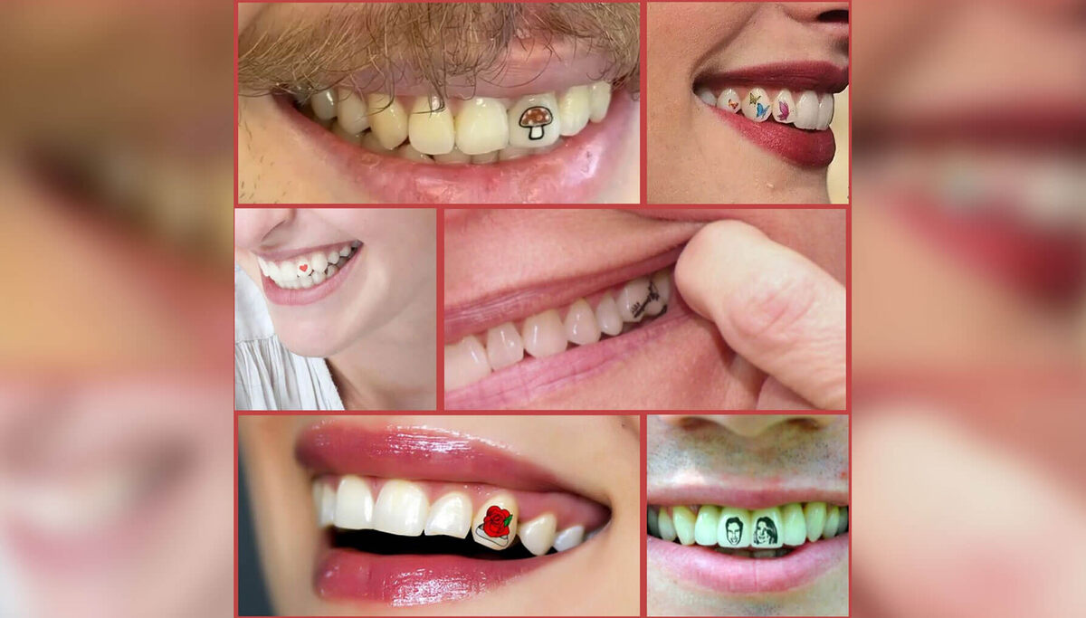    Примеры татуировок на зубах. Источник изображения: dzen.ru