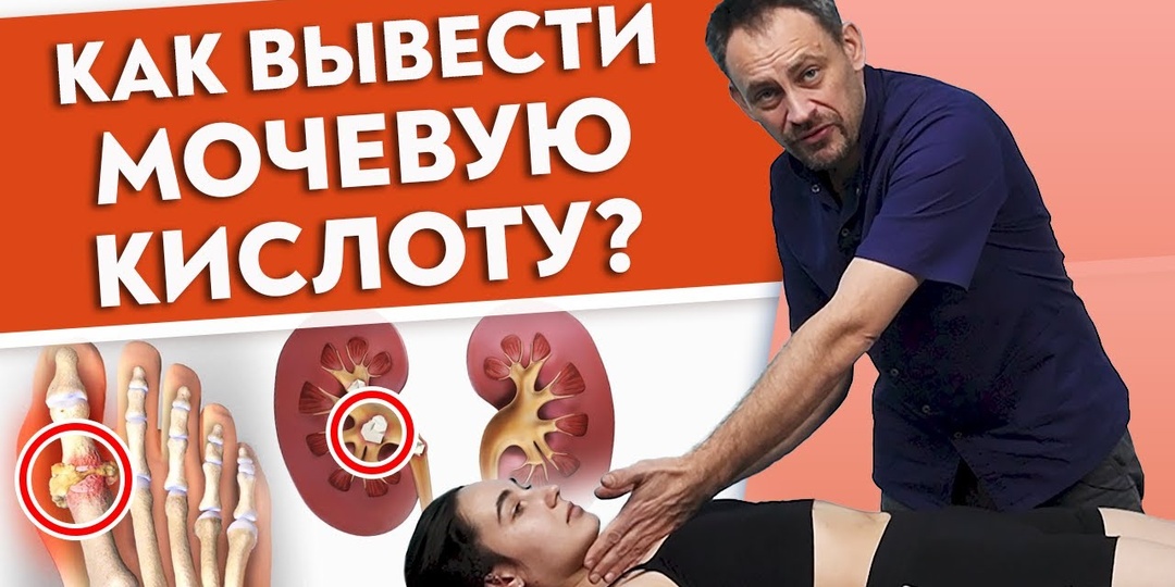 Мочевая кислота: скрытая угроза для суставов, о которой молчат врачи