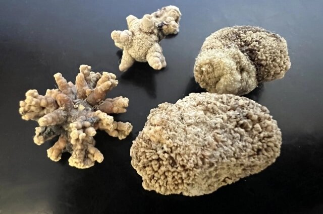    Коралловидные образования — главные «злодеи» мочекаменной болезни. Фото: Из архива/ Светлана Юдина