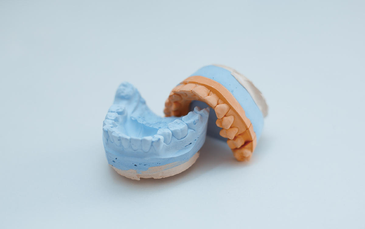 Фотография взята с сайта стоматологии Дмитрович Фэмили https://www.dmitrovich.ru/