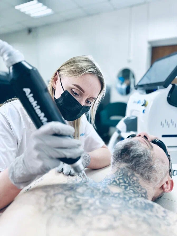 Лазер по удалению татуировок Aleklamed