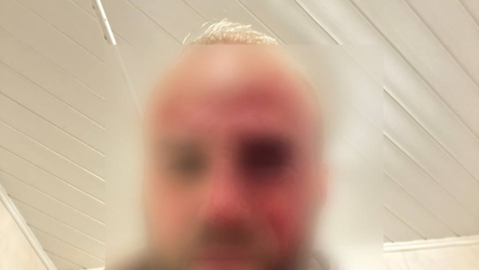    Избитый в центре Барнаула мужчина. Источник: Barnaul 22