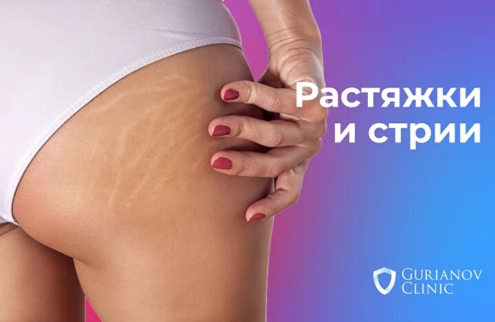 https://gurianov-clinic.ru/rastyajki